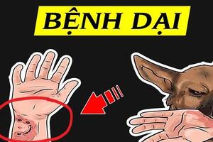 40 người tử vong vì bệnh dại kể từ đầu năm