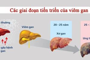 CÁC BIỂU HIỆN VÀ BIẾN CHỨNG CỦA VIÊM GAN B
