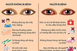 CÁCH PHÒNG TRÁNH LÂY LAN CỦA BỆNH ĐAU MẮT ĐỎ