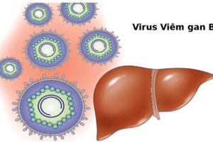 BỆNH VIÊM GAN VIRUS VÀ CÁCH PHÒNG BỆNH