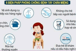 BỆNH TAY CHÂN MIỆNG - KHÔNG NÊN CHỦ QUAN