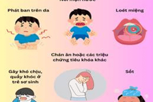 BỆNH TAY CHÂN MIỆNG - CÁC BIỆN PHÁP PHÒNG BỆNH