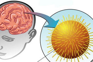 VIÊM NÃO DO VI RÚT HERPES: NGUY HIỂM NHƯNG CÓ THỂ PHÒNG TRÁNH