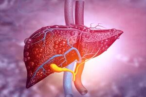 BỆNH GAN NHIỄM MỠ HAY GẶP NHƯNG NGUY HIỂM