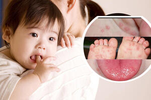 Tay – Chân – Miệng gia tăng nhanh tại khu vực Bình Thuận (cũ): người dân cần nâng cao cảnh giác