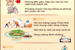 SỞ Y TẾ LÂM ĐỒNG CHỈ ĐẠO ĐẢM BẢO CÔNG TÁC PHÒNG, CHỐNG BỆNH SỞI TRÊN ĐỊA BÀN TỈNH