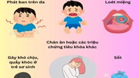 BỆNH TAY CHÂN MIỆNG - CÁC BIỆN PHÁP PHÒNG BỆNH