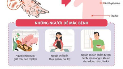 BỆNH LIÊN CẦU LỢN Ở NGƯỜI – NHỮNG ĐIỀU CẦN BIẾT