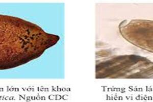 Bệnh sán lá gan lớn ICD-10 B66.3: Fascioliasis thuộc nhóm C trong Luật Phòng, chống bệnh truyền nhiễm
