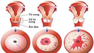 TIN HOẠT ĐỘNG KHÁM CHỮA BỆNH