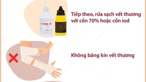 KHI BỊ CHÓ, MÈO CẮN NÊN LÀM GÌ?