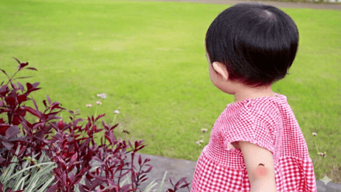 Viêm não Nhật Bản: Cẩn trọng dấu hiệu dễ nhầm với sốt siêu vi